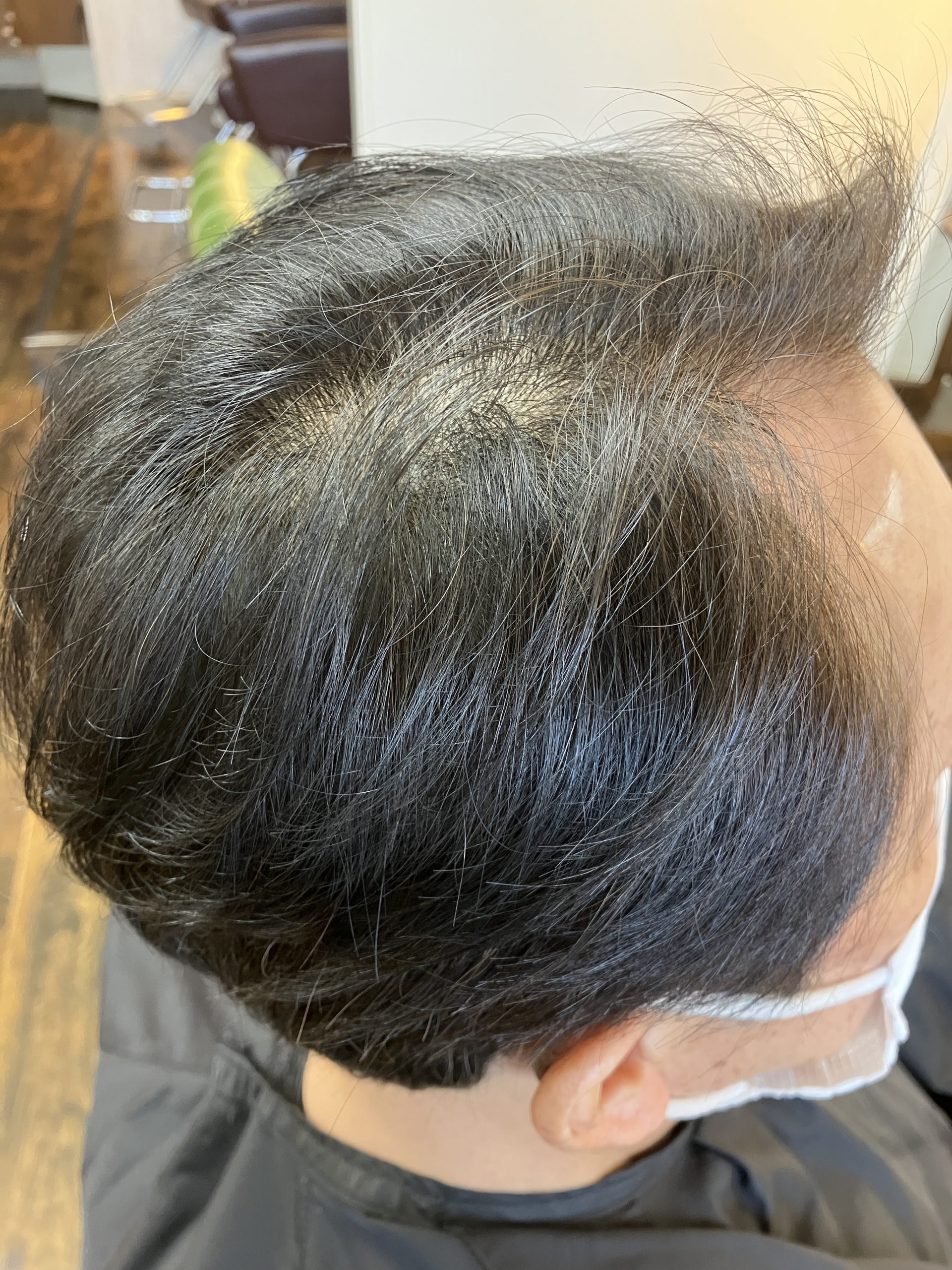 アフター分け目