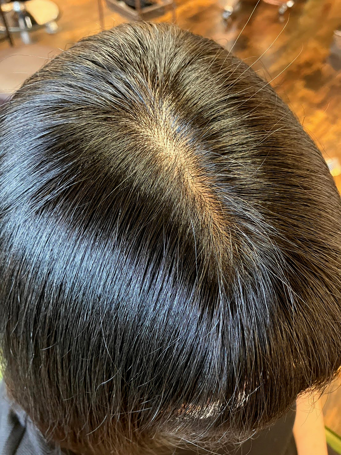 アフター分け目