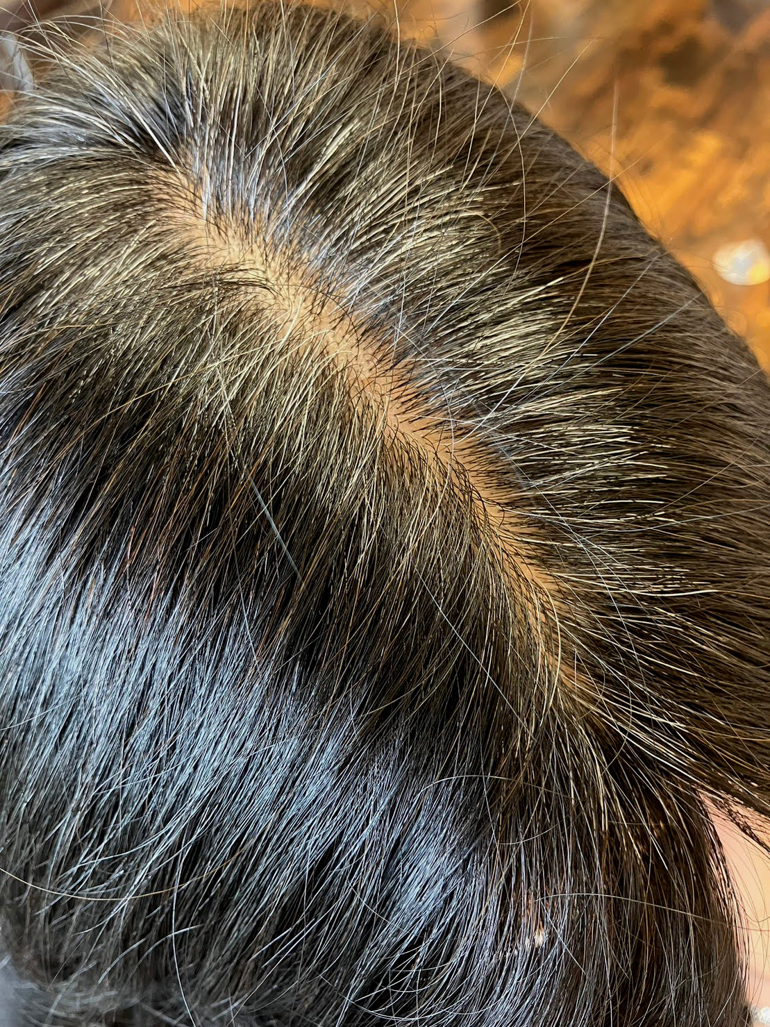 ビフォアー分け目