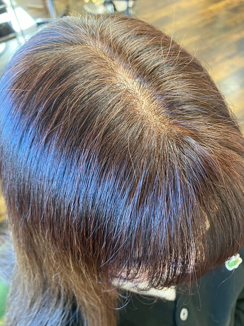 アフター分け目